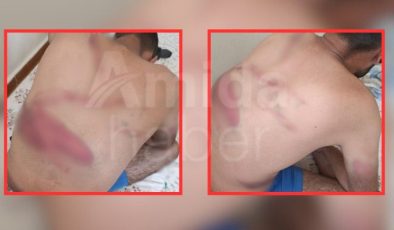 Diyarbakır’da ‘Tefeci’ Kabusu: Kaçırılıp İşkence Edilen M.G. Ölümden Döndü